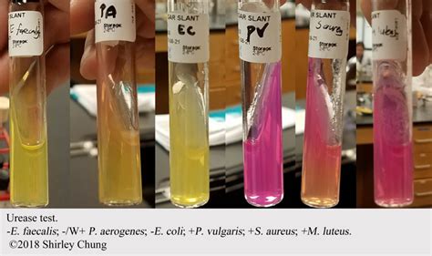 enterobacter aerogenes urease test|Enterobacter aerogenes .